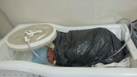 Ainda repercute o caso dos bebês transferidos em saco de lixo em Santa Inês
