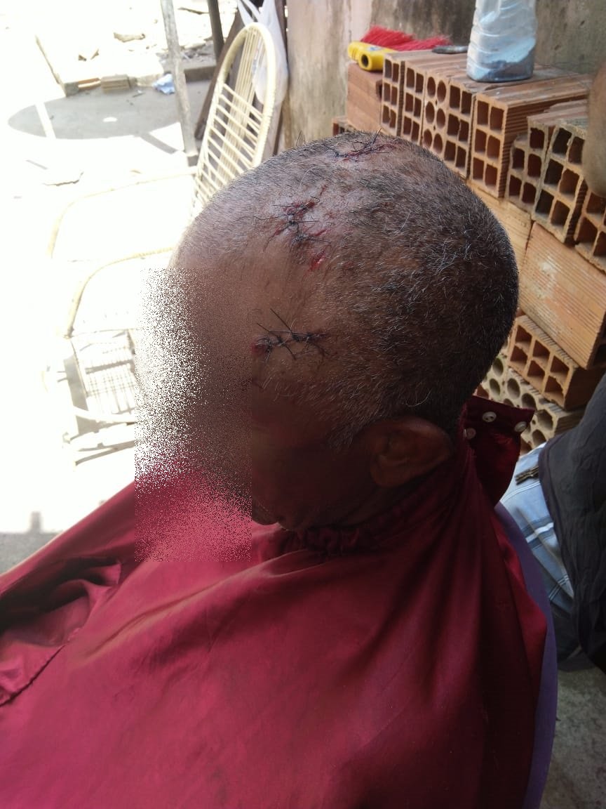 Idoso se recupera após ser agredido durante assalto em Pindaré Mirim