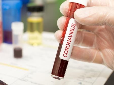 Confirmado o 2º caso de coronavírus em Pindaré Mirim